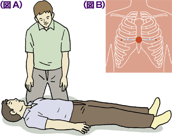 圧迫 胸骨